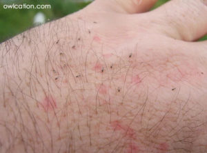 Biting midges are not mosquitoes.